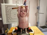 Baby squeezed into glass tube for an X-ray