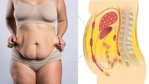 पेट की चर्बी डायबिटीज का कारण कैसे | Belly Fat Diabetes Ka Karan kaise | Boldsky