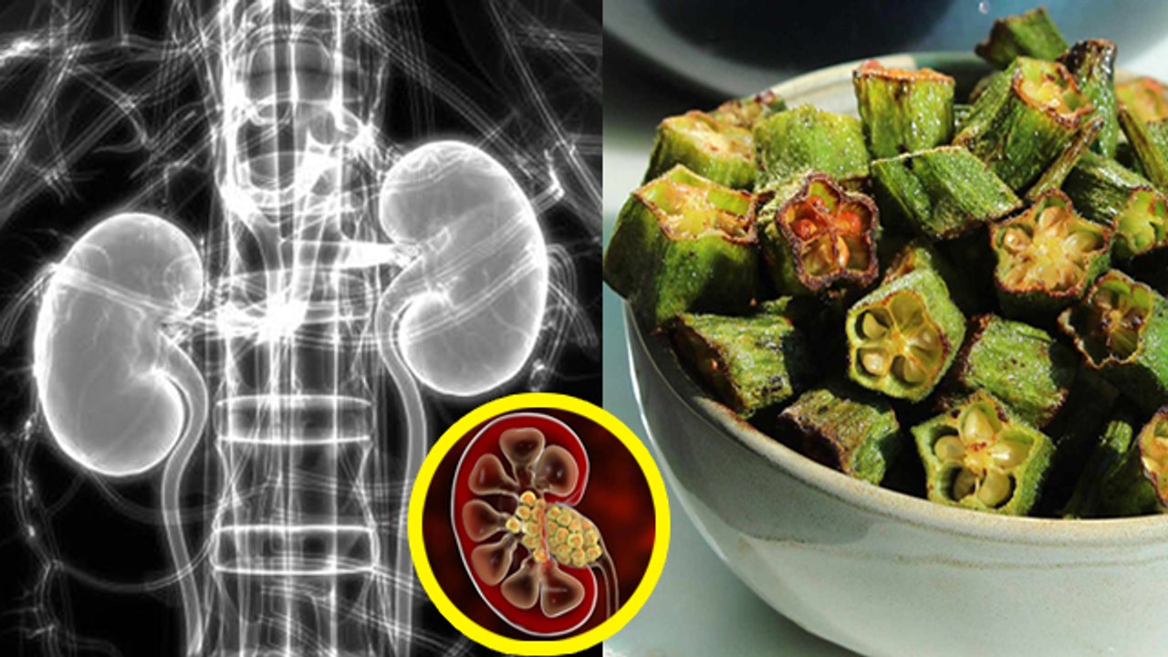 पथरी में भिंडी खाना चाहिए या नहीं | Pathri Mein Bhindi Khana Chahiye Ya Nahi | Boldsky