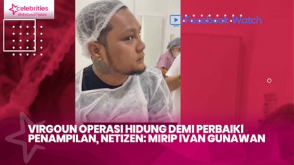 Virgoun Operasi Hidung Demi Perbaiki Penampilan, Netizen : Mirip Ivan Gunawan