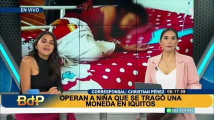 Loreto: Tras ser operada dan de alta a menor que se tragó una moneda