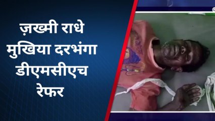 मधुबनी: जमीन विवाद में दो पक्षों में मारपीट, मुखिया घायल