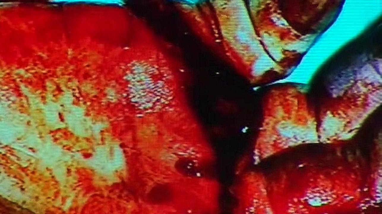 Autopsy Emergency Room - Massive Blood Loss