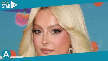« Je vais mieux » : Bebe Rexha dévoile un cliché impressionnant de son oeil au beurre noir après l'a