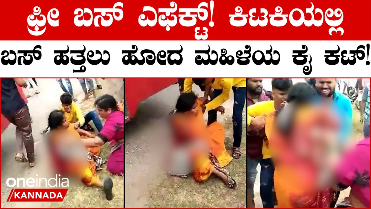 ಮಂಡ್ಯದಲ್ಲಿ ಕಿಟಕಿಯಲ್ಲಿ ಬಸ್ ಹತ್ತಲು ಹೋದ ಮಹಿಳೆಯ ಕೈ ತುಂಡಾಗಿದೆ: ಸರ್ಕಾರಕ್ಕೆ ಜನರ ಹಿಡಿ ಶಾಪ