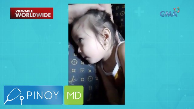 Seizure attacks sa mga bata, ano ang dahilan? | Pinoy MD