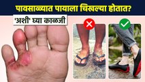 पावसाळ्यात पायांना चिखल्यांचा त्रास होतो का? How to Cure Fungal Infection On Skin |Lokmat Sakhi AI2