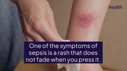 Sepsis Can Cause a Red Line on Your Skin—Here's What You Need To Know