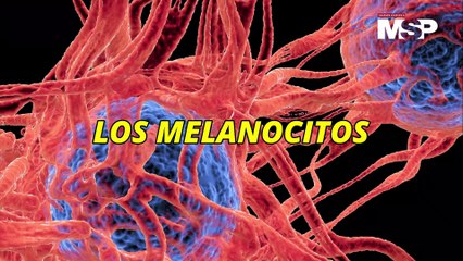 Día Mundial del Vitíligo: ¿Qué es y cómo funciona? - #ExclusivoMSP