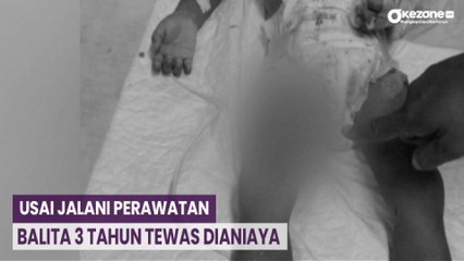 OKEFLASH: Usai Jalani Perawatan, Balita 3 Tahun Tewas Dianiaya