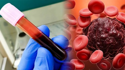 ESR Blood Test kya hai | इ.एस.आर ब्लड टेस्ट क्या है | ESR Blood Test Normal Range Kitni Hoti Hai