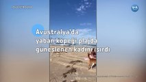 Avustralya’da yaban köpeği plajda güneşlenen kadını ısırdı