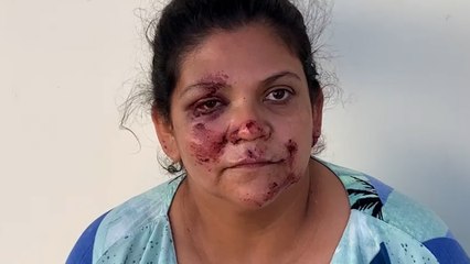 MULHER ESPANCADA EM CASCAVEL