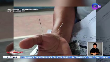 Nasa 100 residente, nabigyan ng libreng acupuncture treatment | BT