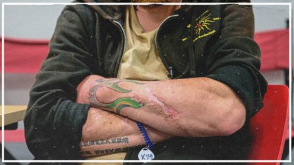 Fentanyl und das tödliche Xylazin: Neue Gefahr für US-Suchtkranke 🚨