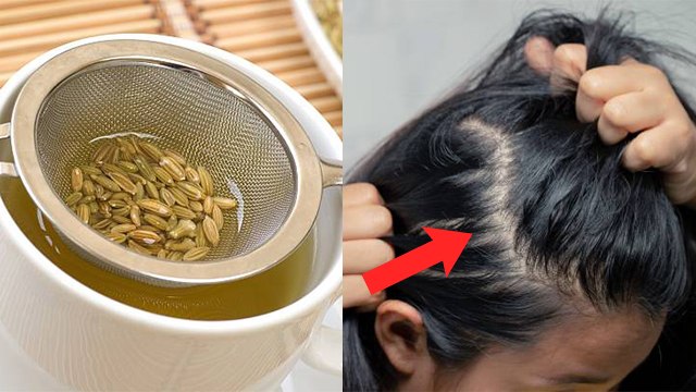 Monsoon Hairfall Tips: बरसात में झड़ते बाल रोकने का जबरदस्त तरीका | Boldsky