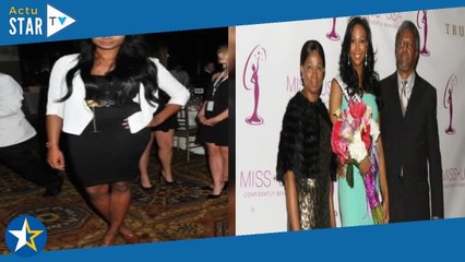 Régime sans sucre : une ex-Miss USA dévoile les bénéfices incroyablement rapides sur sa peau