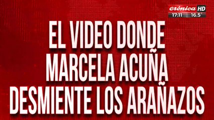 El video donde Marcela Acuña desmiente los arañazos