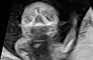 Whitney Cummings reveals she's having a baby boy and shares her 'favourite' sonogram