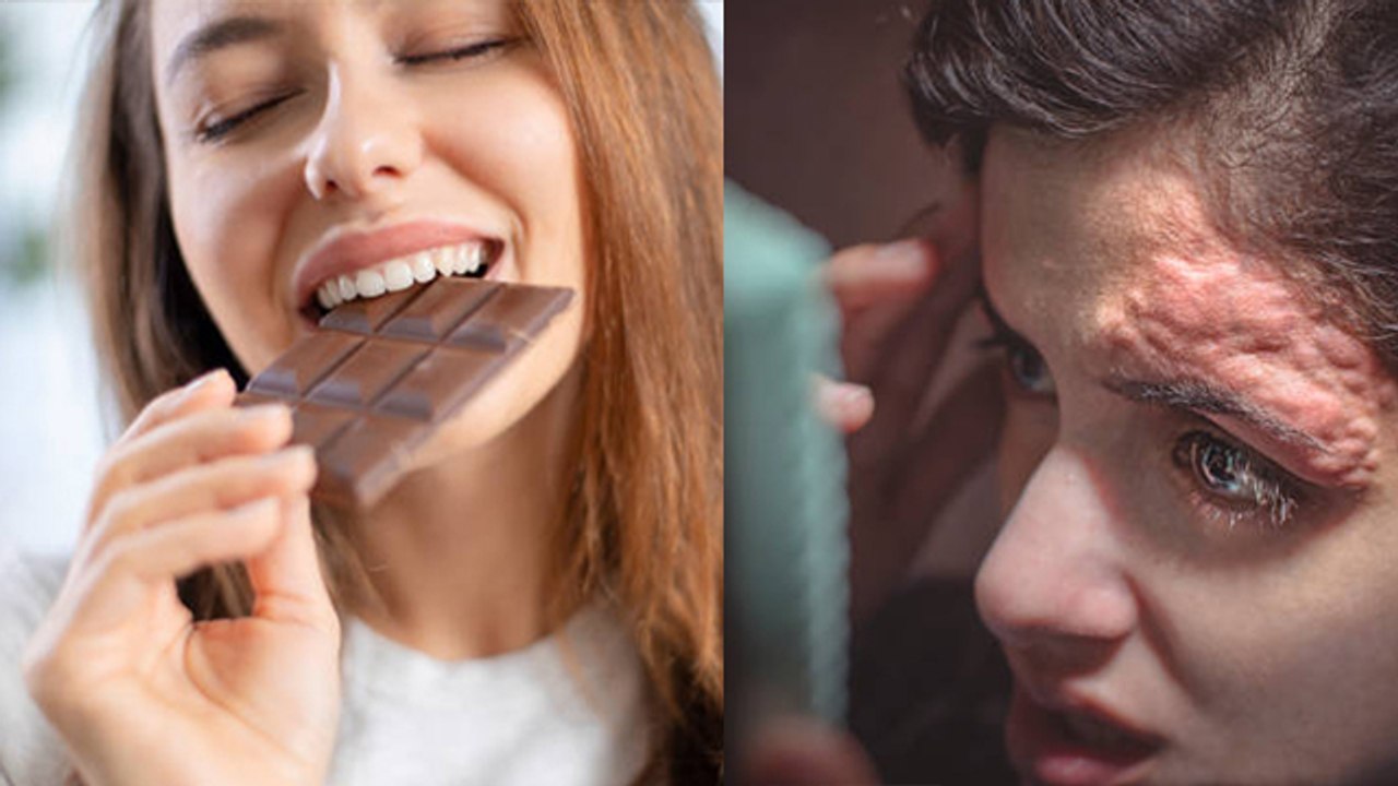 मीठा खाने से स्किन को क्या नुकसान । Meetha Khane Se Skin Ko Kya Nuksan Hota Hai। Boldsky