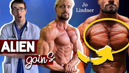 LA MALADIE GÉNÉTIQUE DE JO LINDNER (et personne ne le savait)