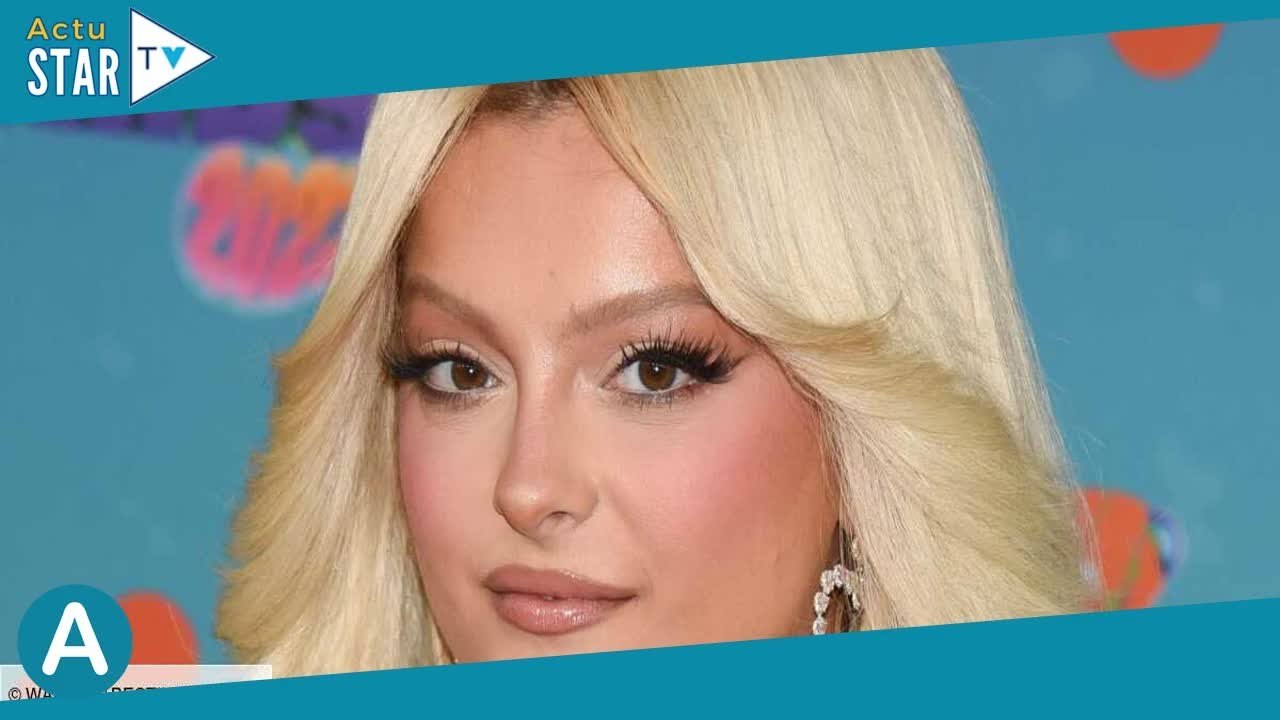 « Je vais mieux » : Bebe Rexha dévoile un cliché impressionnant de son oeil au beurre noir après l'a