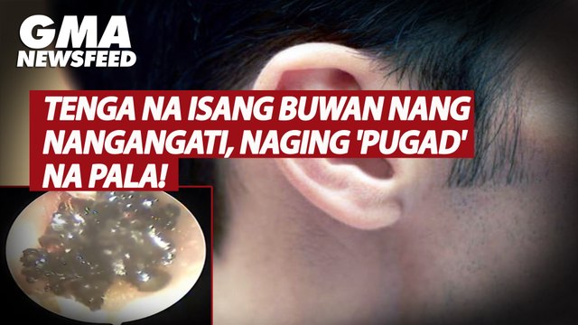Tenga na isang buwan nang nangangati, naging 'pugad' na pala! | GMA News Feed