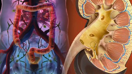 Kidney Stone Pain Body में कहाँ होता है, Symptoms को न करें नज़रअंदाज़ | Boldsky