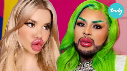 Are We Addicted To Fillers? | HOOKED ON THE LOOK