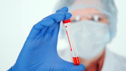 Pruebas de laboratorio