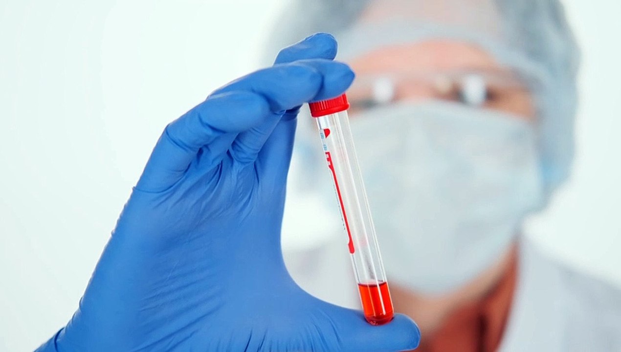 Pruebas de laboratorio