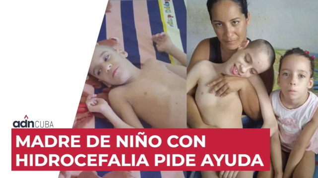 Madre de niño con hidrocefalia pide ayuda