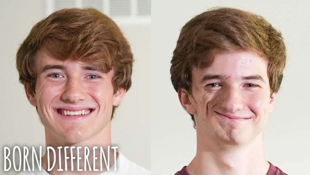We're Identical Twins - But Only On One Side |...