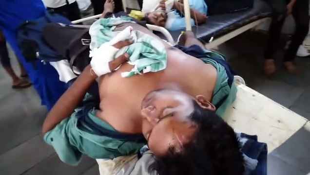 औंकारेश्वर दर्शन के लिए जा रहे श्रद्धालु की कार को ट्रक ने मारी टक्कर, एक की मौत, 6 गंभीर घायल