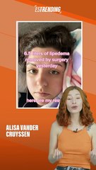 Un mujer se curó después de descubrir su condición medica al ver YouTube