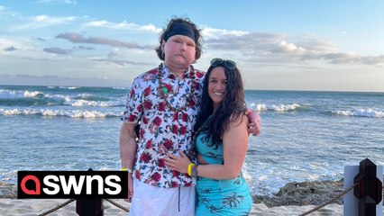 "I had world's first face and double hand transplant - my donor was TWICE my age"