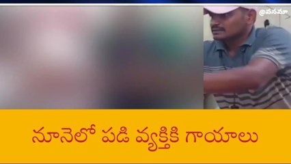 పాల్వంచ: వేడి వేడి నూనెలో పడి వ్యక్తికి గాయాలు