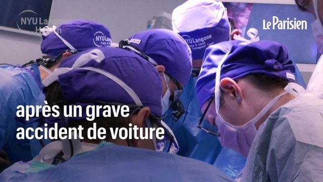 Greffé des mains et du visage, Joe DiMeo ouvre un compte TikTok