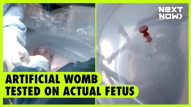 Artificial womb tested on actual fetus | NEXT NOW