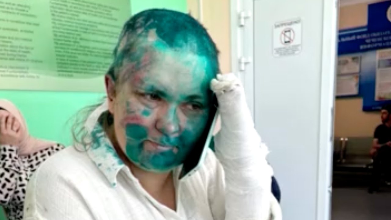 Crâne rasé, doigts cassés : une journaliste russe passée à tabac en Tchétchénie