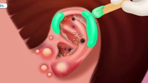 ASMR Ear Cleaning and Tranquil Removal Animation for Deep Relaxation