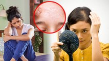 Period में Hair Skin Dry का Reason आया सामने | पीरियड में बाल स्किन ड्राई का कारण क्या है | Boldsky