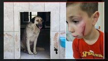 Tatil için Türkiye'ye gelen küçük çocuğa, başıboş sokak köpeği saldırdı