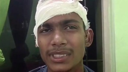 ब्रेकिंग: अज्ञात बदमाशों ने पिस्टल के बट से युवक को मारकर किया घायल, सुनिए आपबीती