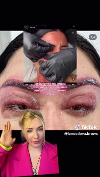 Influencer 33enne rovinata dalla chirurgia estetica