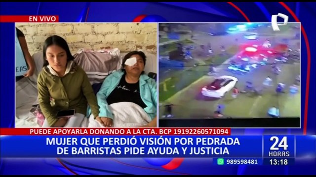Hija de mujer que perdió un ojo por pelea de barristas pide apoyo a la U y Alianza Lima