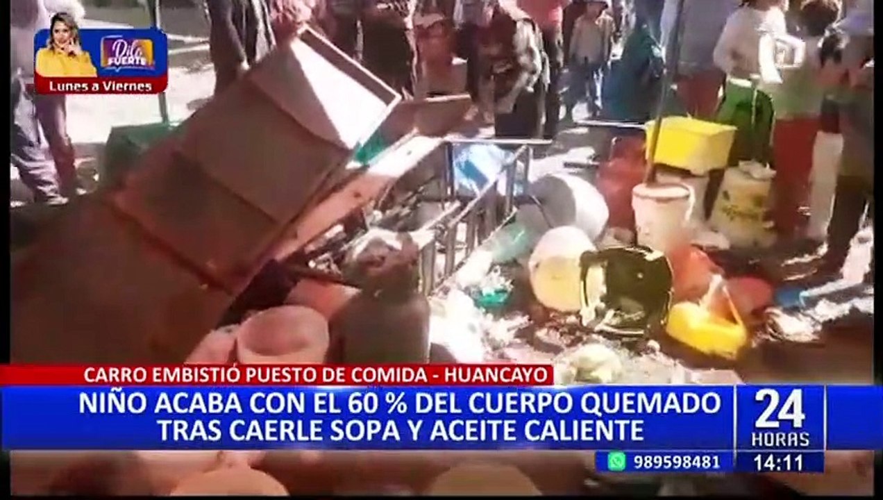 Huancayo: madre de niño con quemaduras de 60% pide cama en el Instituto de Salud del Niño