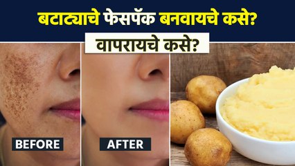 बटाट्याचे फेसपॅक तुम्ही कसे बनवता आणि वापरता? जाणून घ्या योग्य पद्धत | Potato Face Pack | AI2