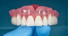 Protesista desvenda mitos e verdades da prótese dentária e explica importância da reabilitação oral