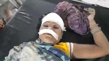 छतरपुर: मजदूरी का कार्य करते समय महिला के साथ हुआ हादसा, सिर पर गिरा पेड़